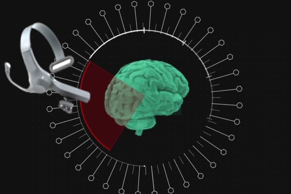 Brain-Computer Interfaces