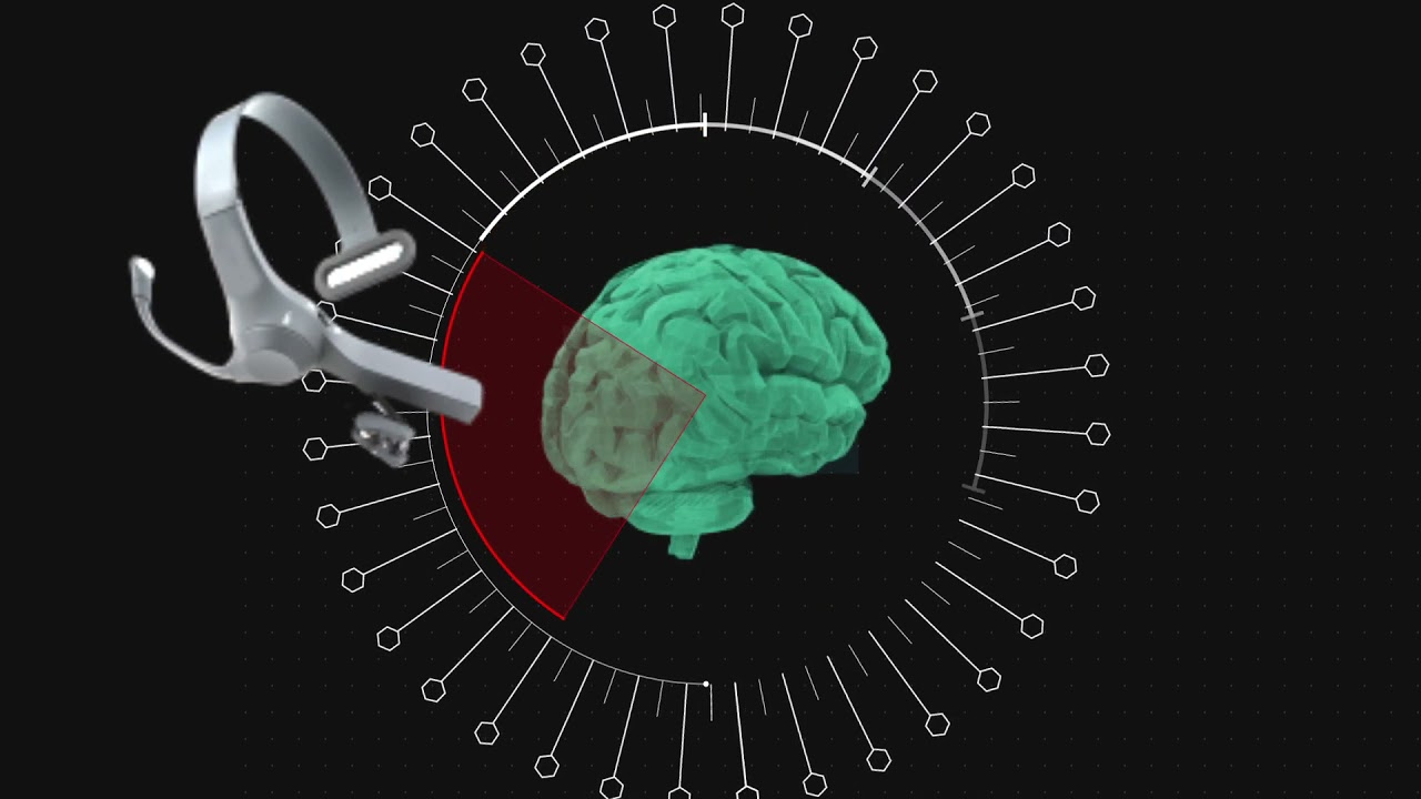 Brain-Computer Interfaces